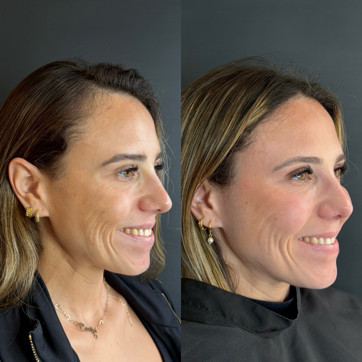 Resultado Camila