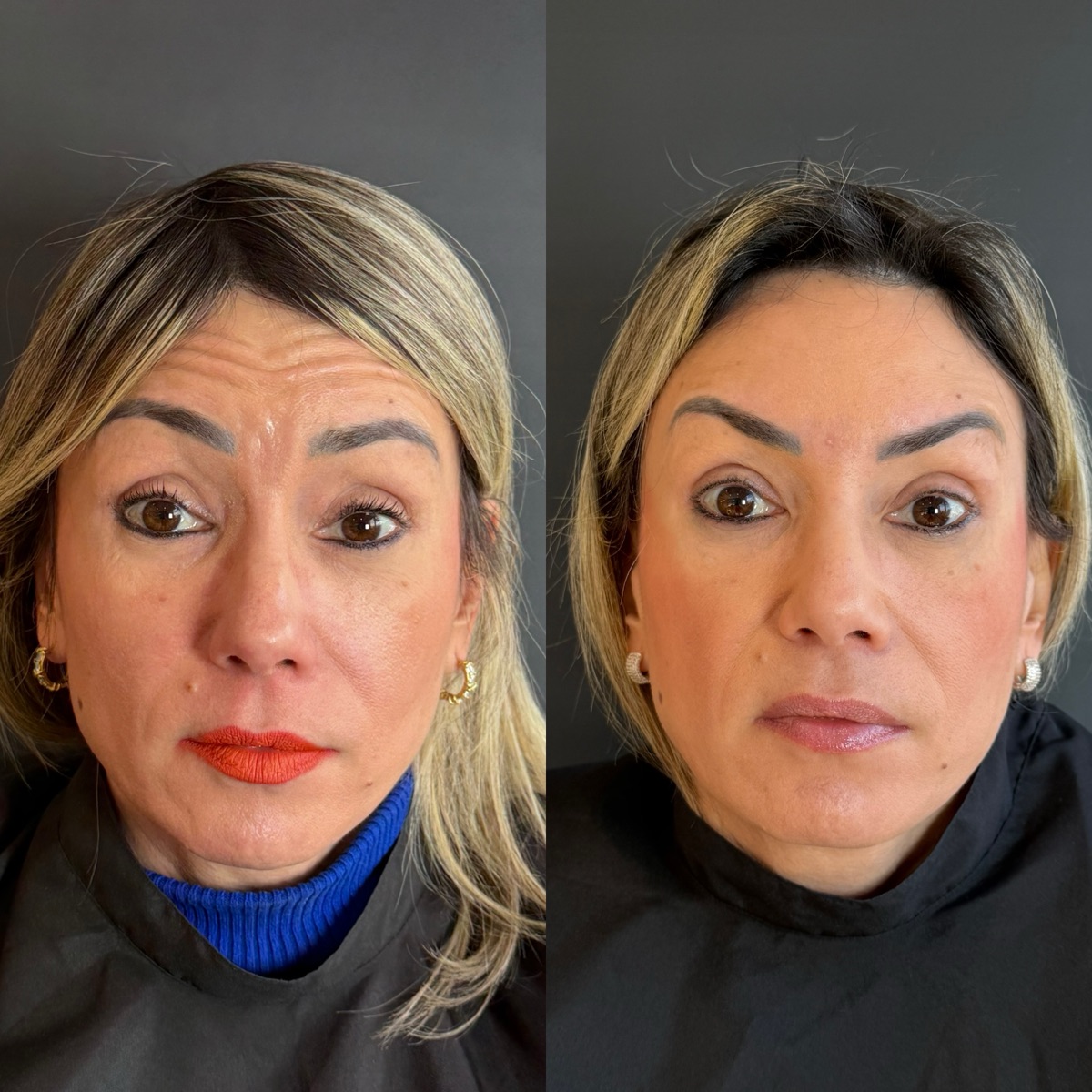 Resultado Katia